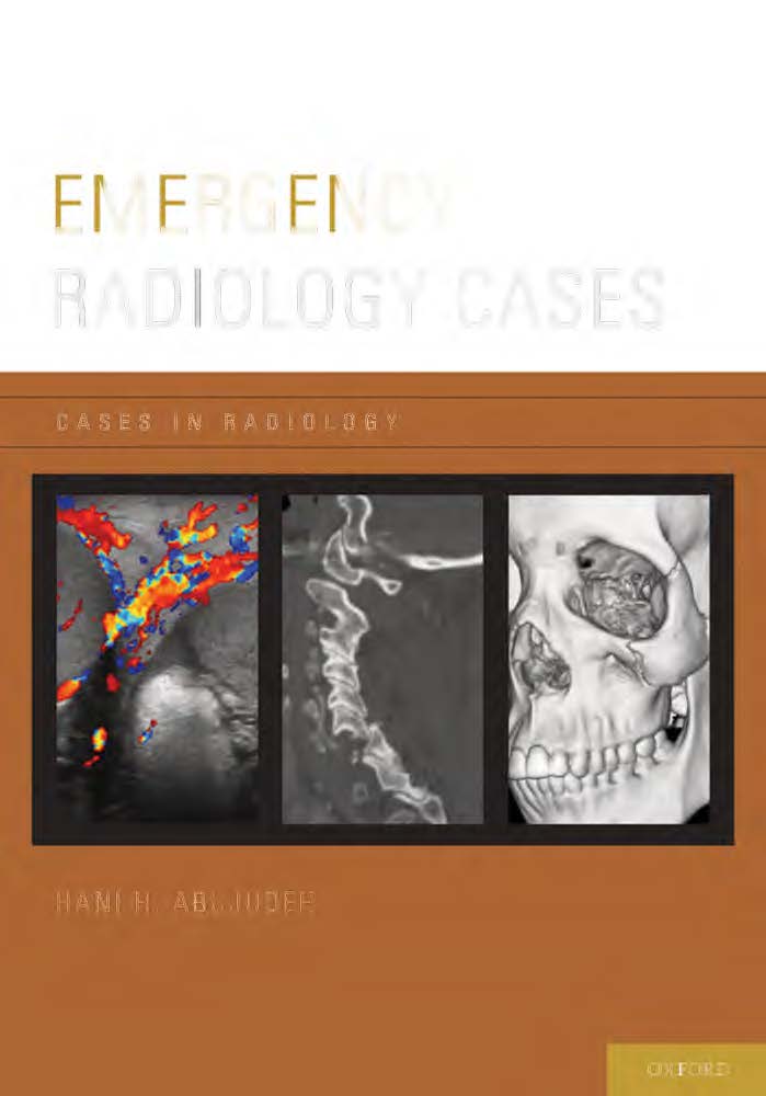 Cases In Radiology - Emergency Radiology Cases